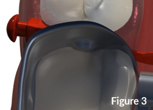 dented-matrix-top-view-300x216