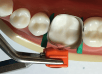 Tighten Band with Wedges in place